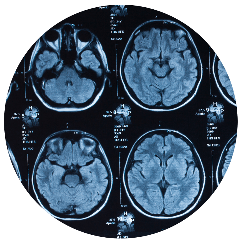 Image showing slices of a brain MRI